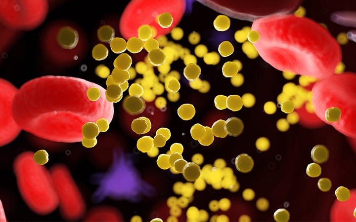 Illustration of fat in blood vessels