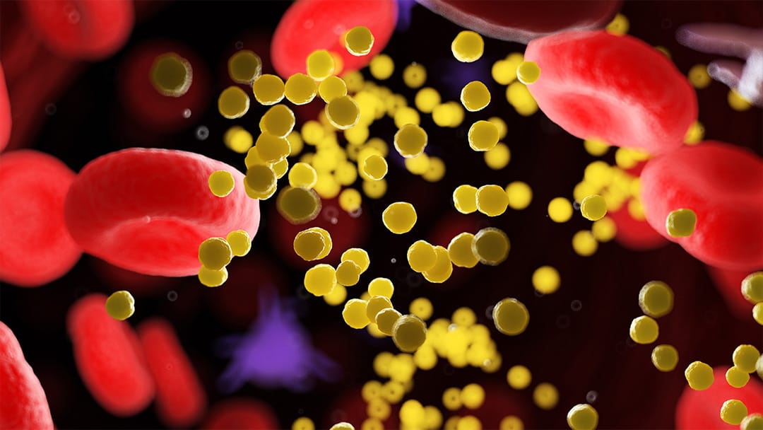 Cholesterol Guidelines Are Changing: Here’s What’s New | University ...
