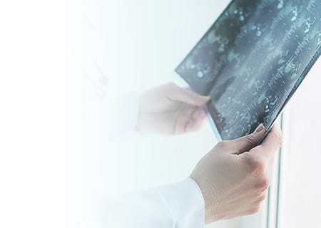 Magnetic resonance imaging results in the doctor's hands