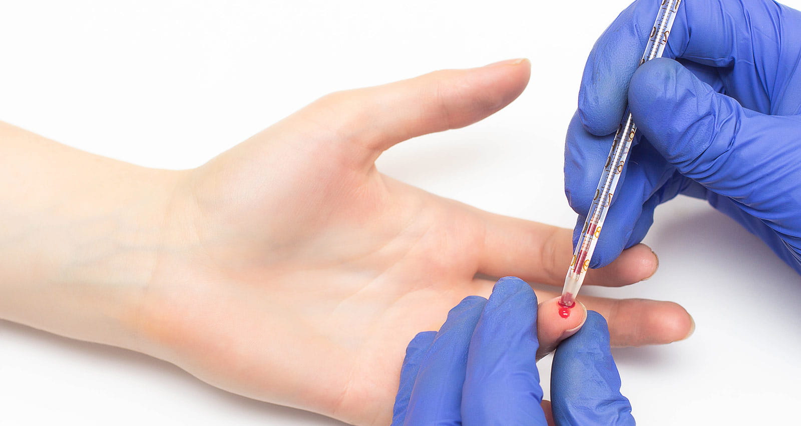 A doctor administering a blood test for allergens