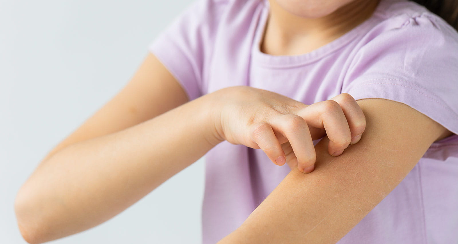 A little girl scratching her arm