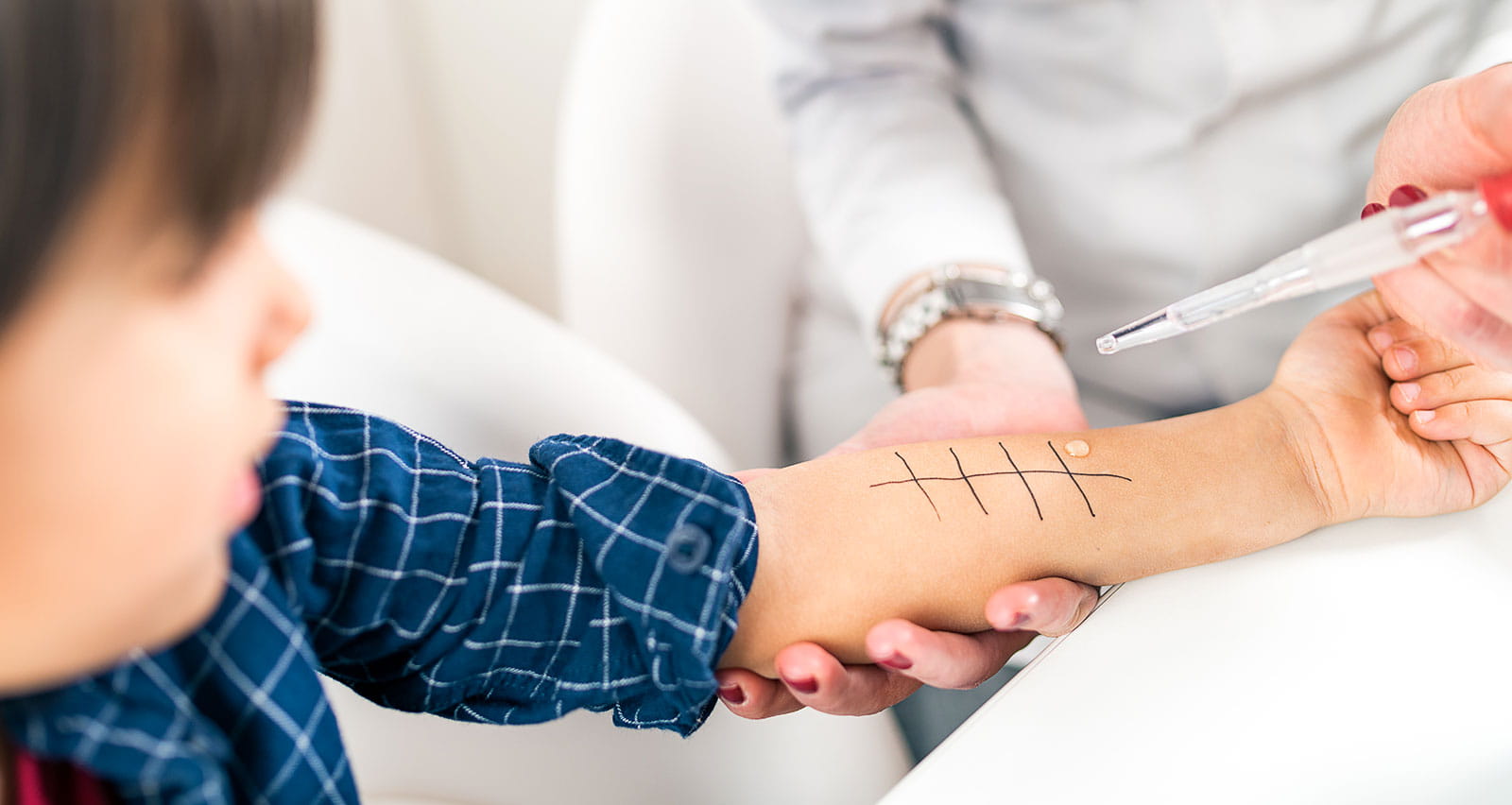 Skin prick allergy testing for children