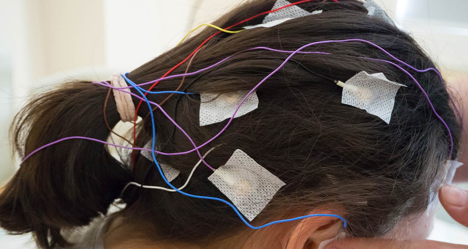 Girl with EEG electrodes attached to her head