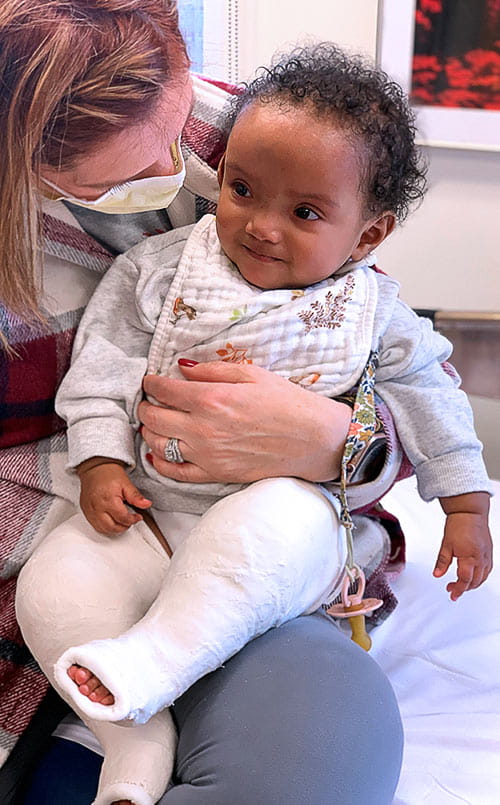 An infant wearing casts on her legs