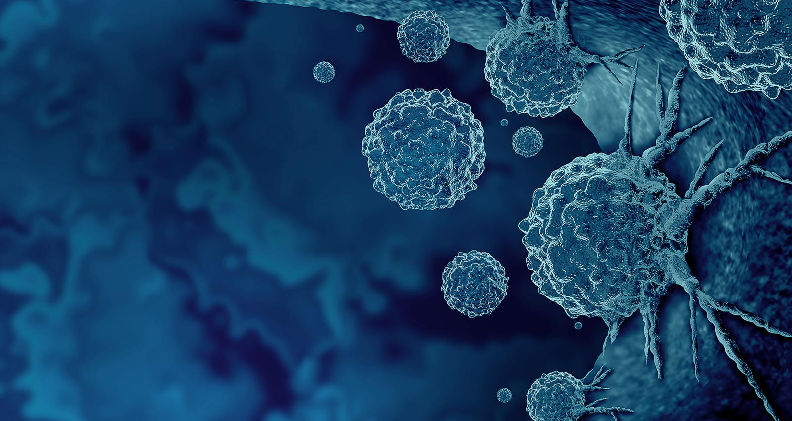 Illustration of cancer cells in a human body