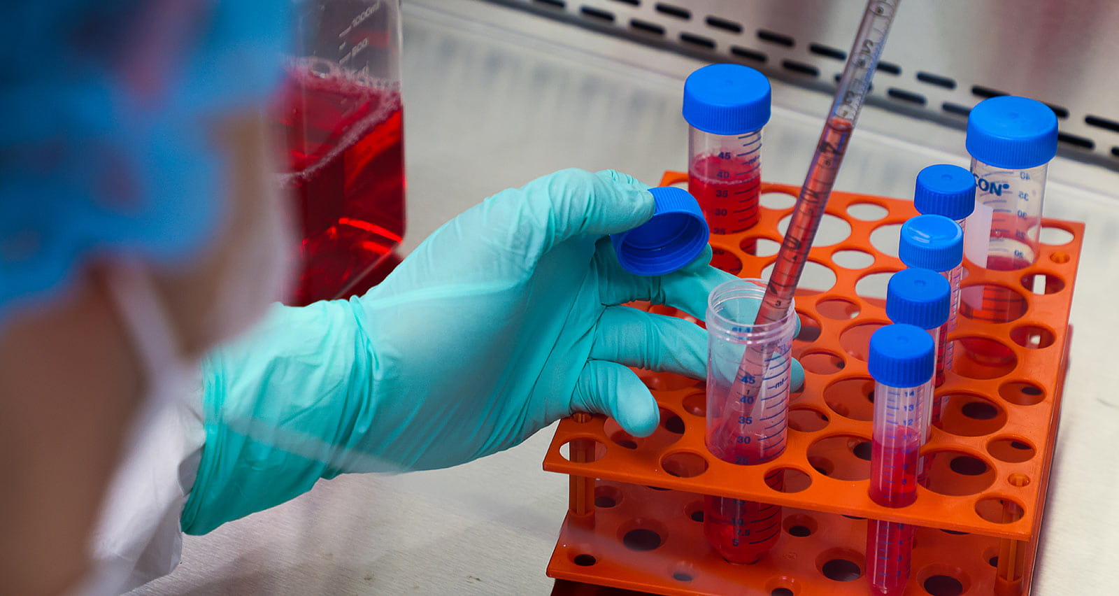 A cell therapy researcher at the Wesley Center for Immunotherapy