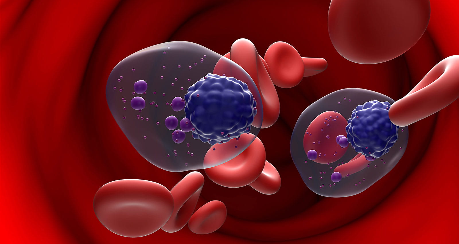 Illustration of multiple myeloma cells