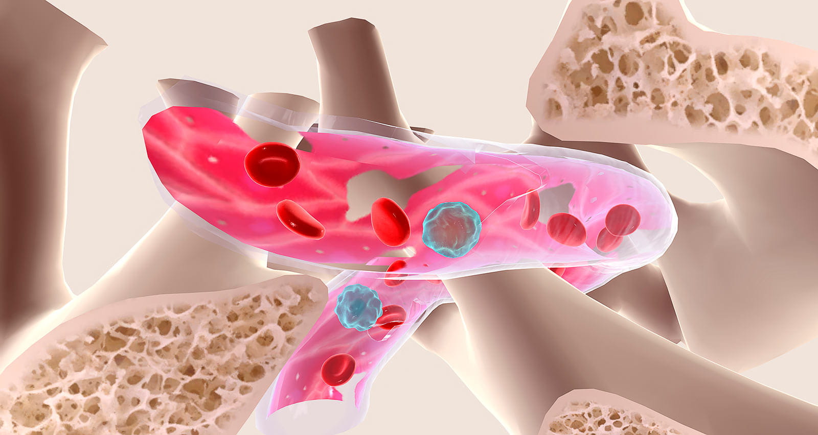Illustration of irregular, dysfunctional blood cells caused by myelodysplastic syndromes