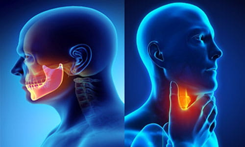 Illustration of Head and Neck Cancer