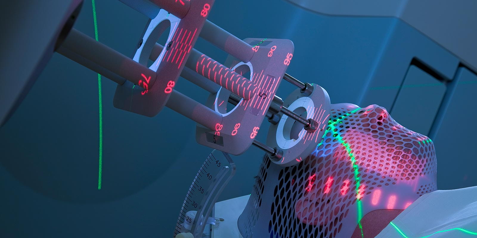 Man Receiving Radiation Therapy for Sarcoma Treatment