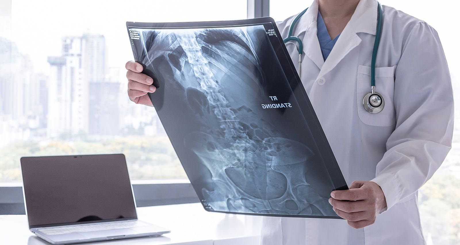 Doctor examines kidney x-ray