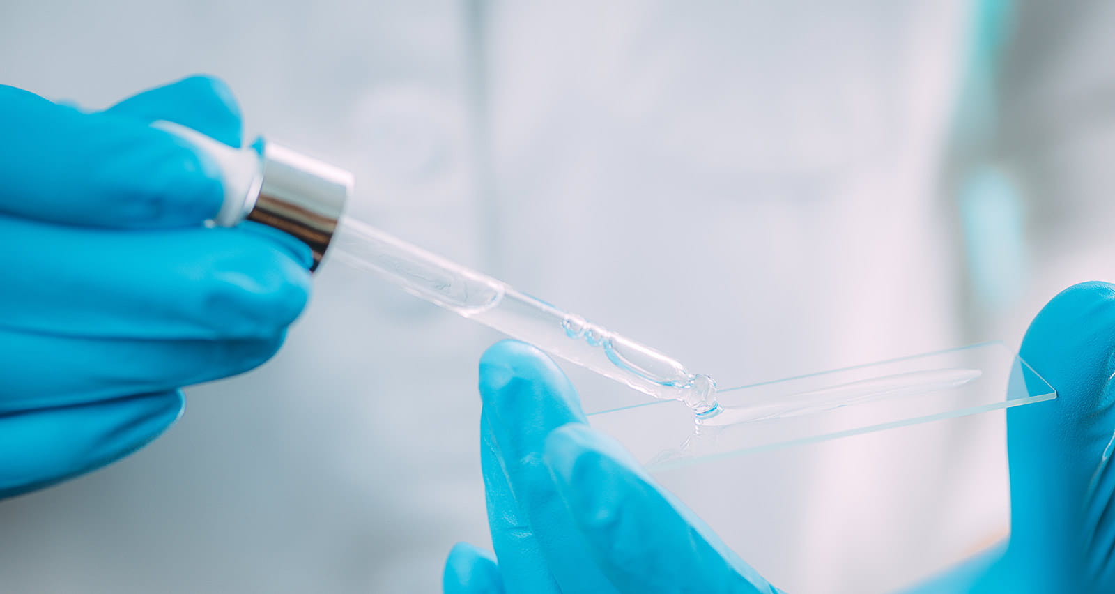 A provider holds a syringe and slide containing hyaluronic acid fillers