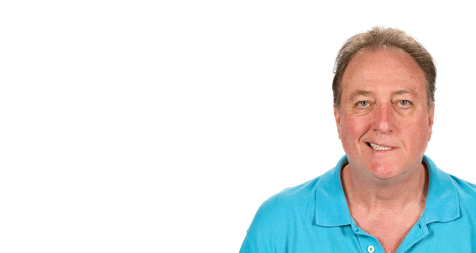 A mature man with Bell's palsy causing paralysis of facial the nerve