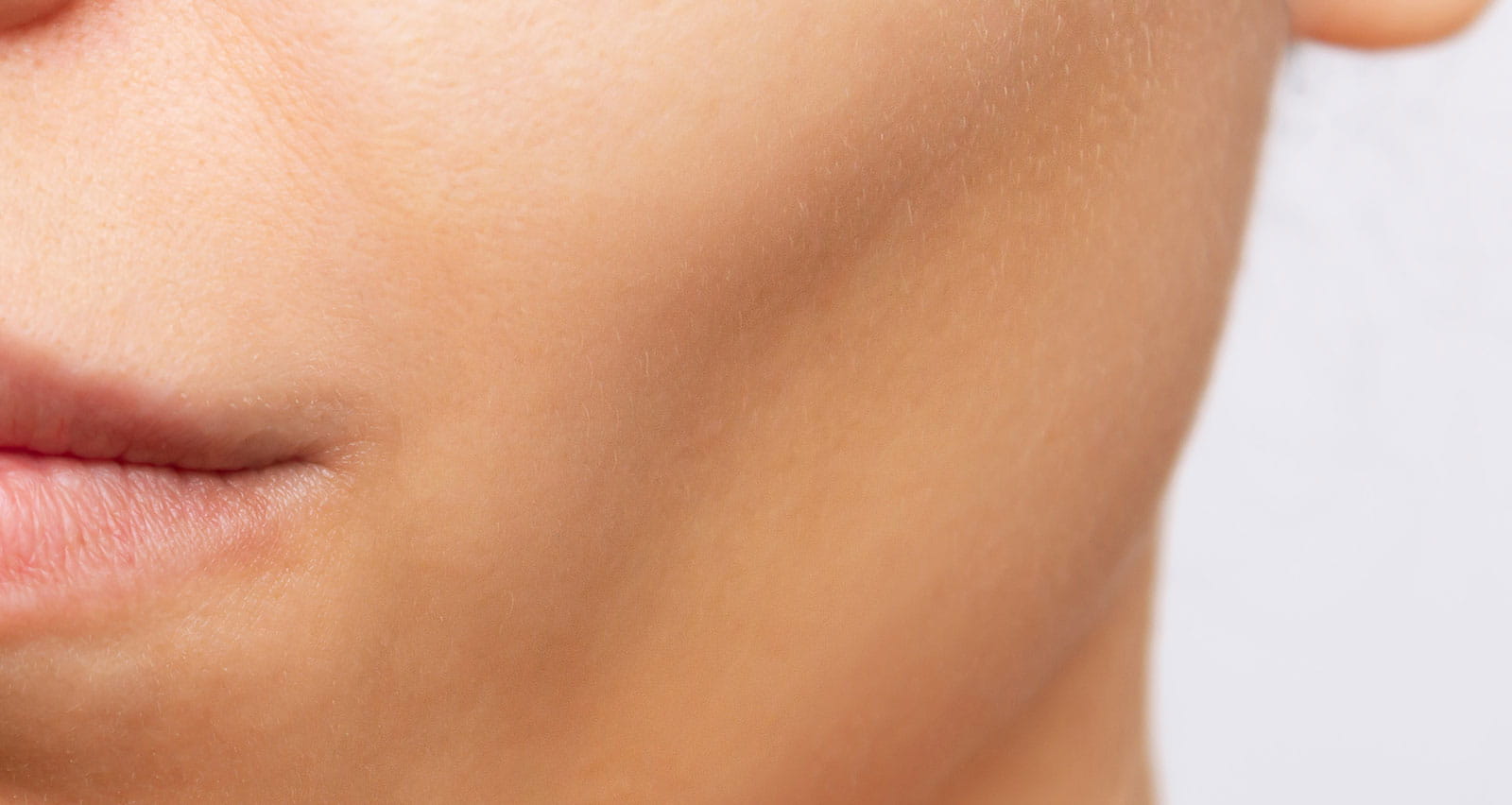 Cropped shot of young woman after plastic surgery buccal fat pad removal