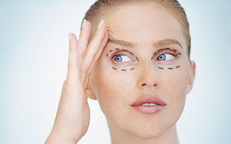 A young woman with markings around her eyes, raising her eyebrows with her fingers 