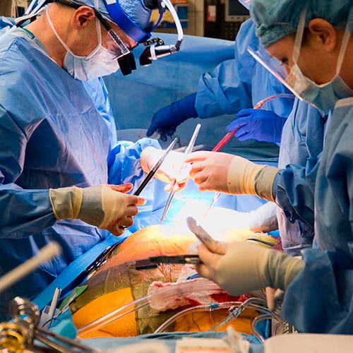 Heart surgeons in the operating theater