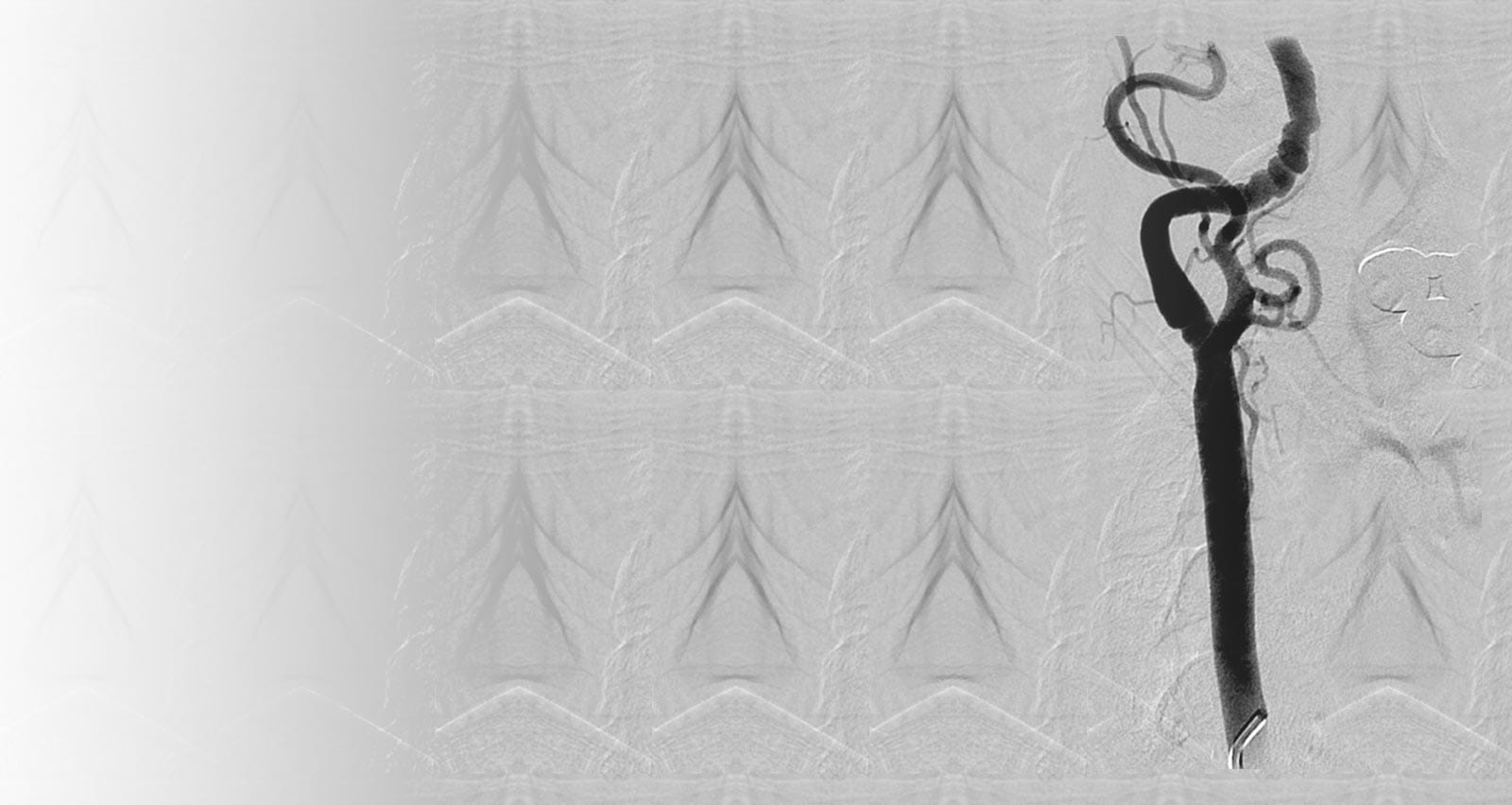 Microscopic view of FMD