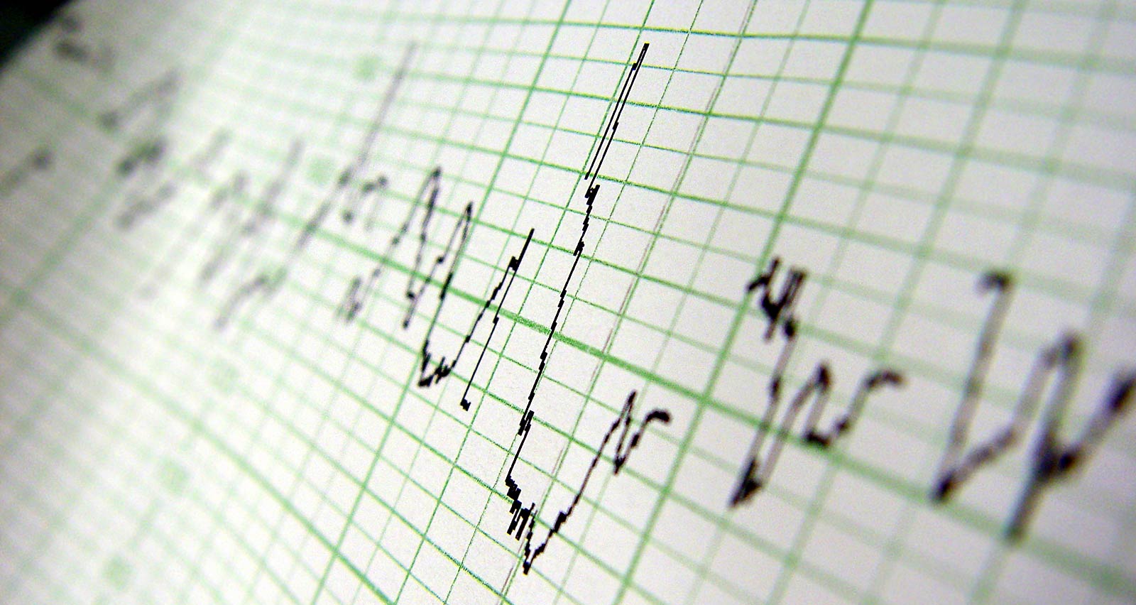 Heart rate on medical print out