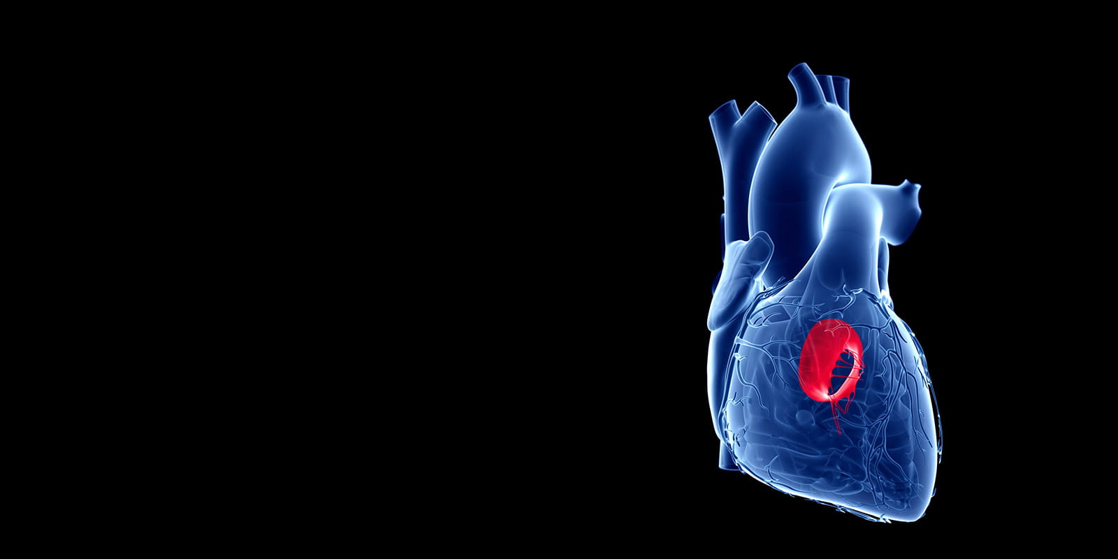 Illustration of heart depicting the Mitral Valve