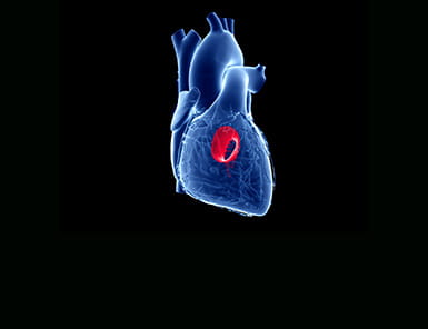 Illustration of heart depicting the Mitral Valve