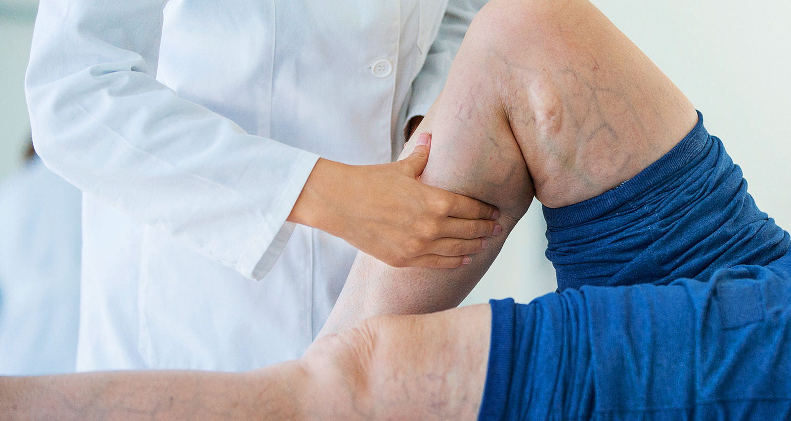 A female doctor massaging the legs and calves of a senior female patient with visible varicose veins