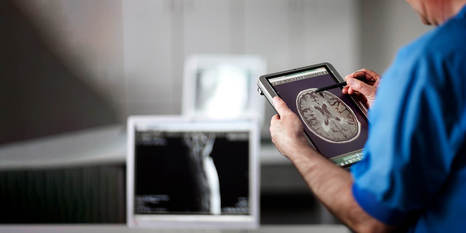 Doctor holding tablet with MR-scan of human brain