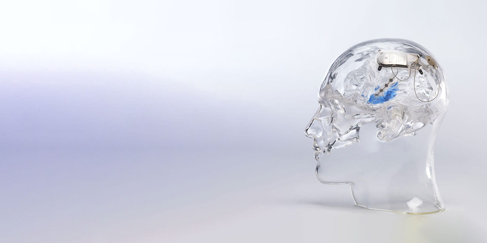 NeuroPace® RNS® System Clear Model