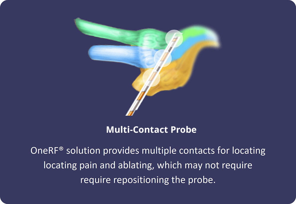 OneRF® Trigeminal Nerve Ablation System Multi-contact Probe