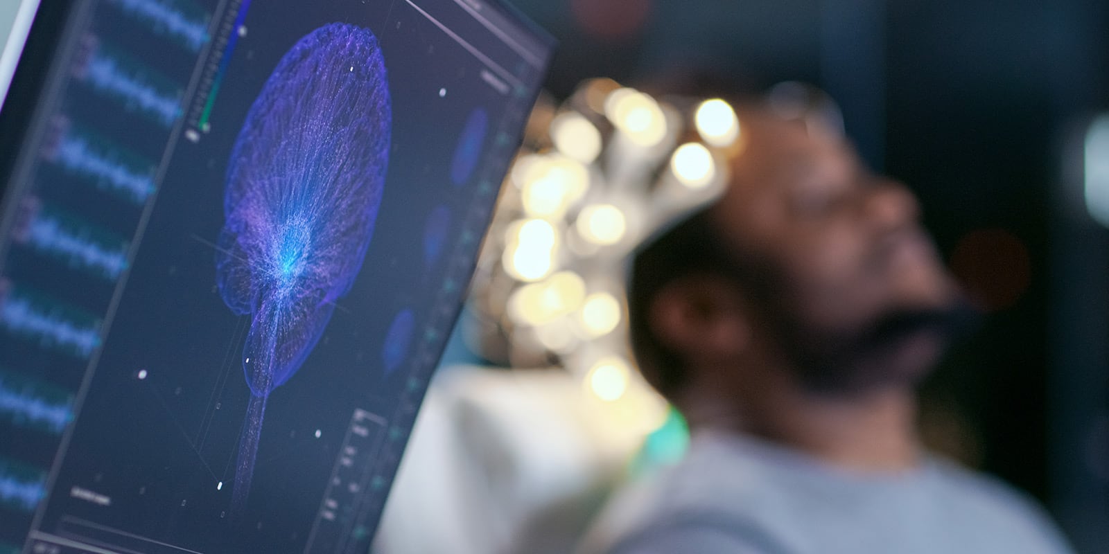 Patient having brain analyzed.