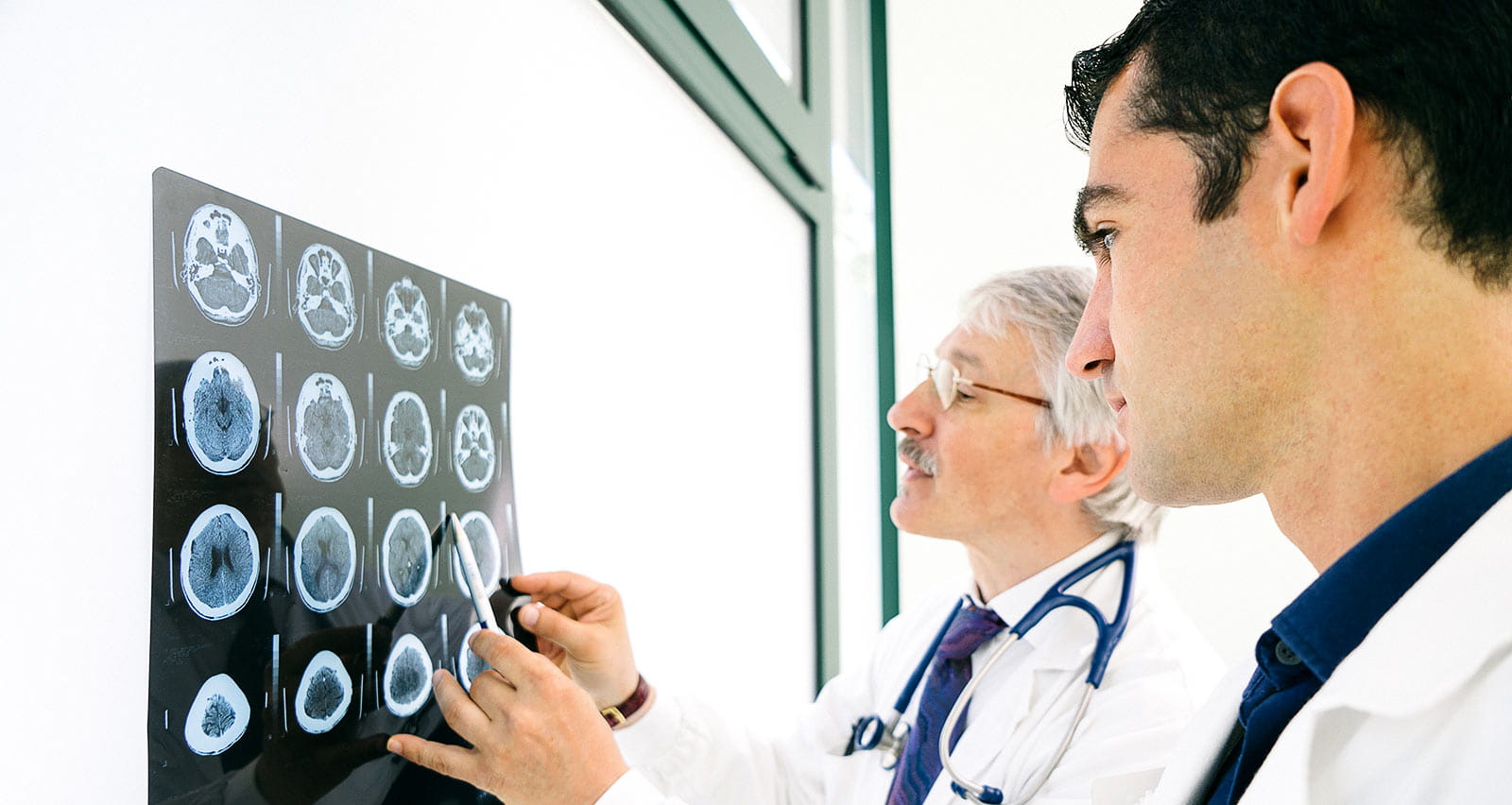Two doctors consult over an MRI scan of a patient treated for stroke