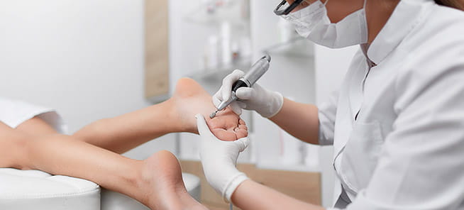 A podiatrist using a special grinding tool on an outstretched foot