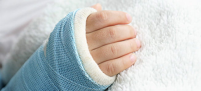 Child wearing arm splint