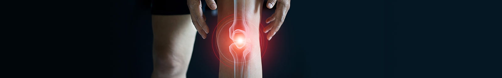 Closeup illustration of artificial knee joint