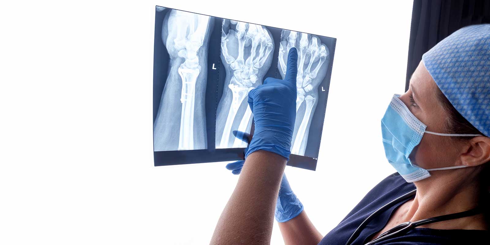 Orthopedic surgeon looking at X-Rays