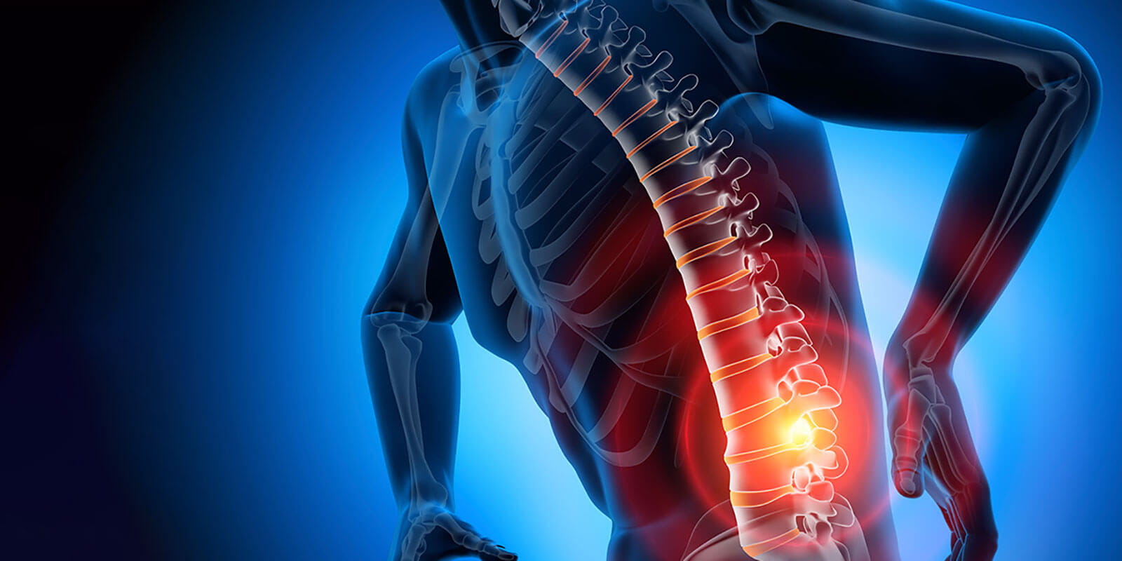Illustration of a male with lower back pain