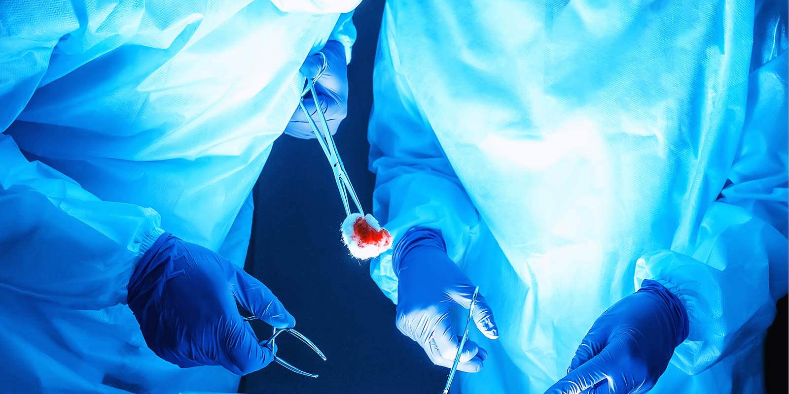 Two surgeons perform a complex colorectal operation to remove a cancerous tumor