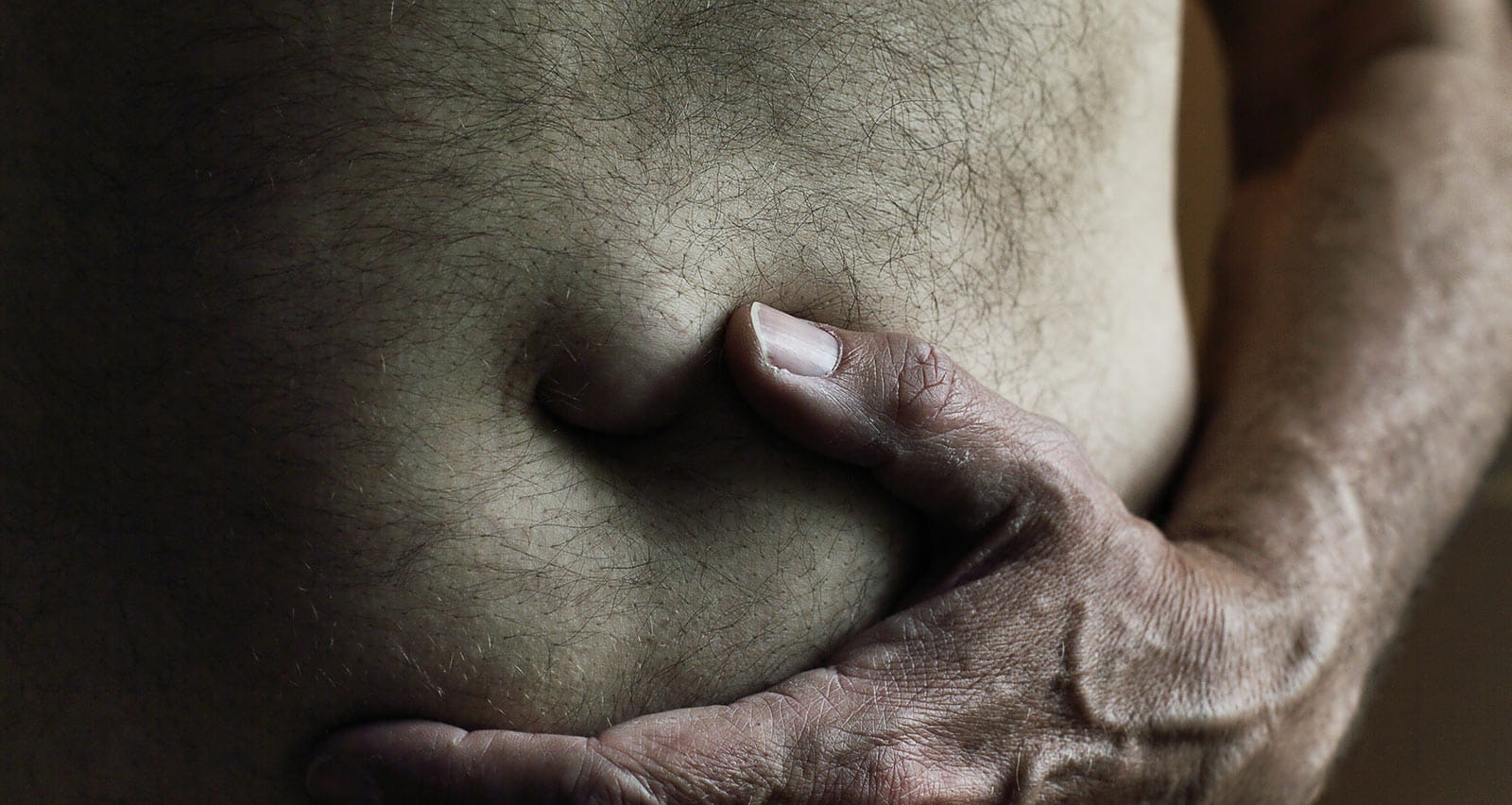 A man holding his belly underneath an umbilical hernia
