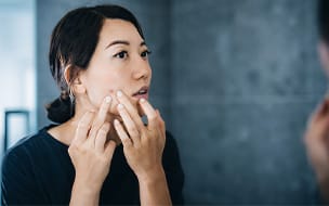 Pimples at Midlife? Why Acne Shows Up in Your 30s and Beyond