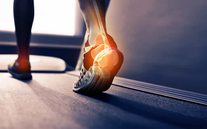 Rear view shot of the highlighted joints in a runner's foot