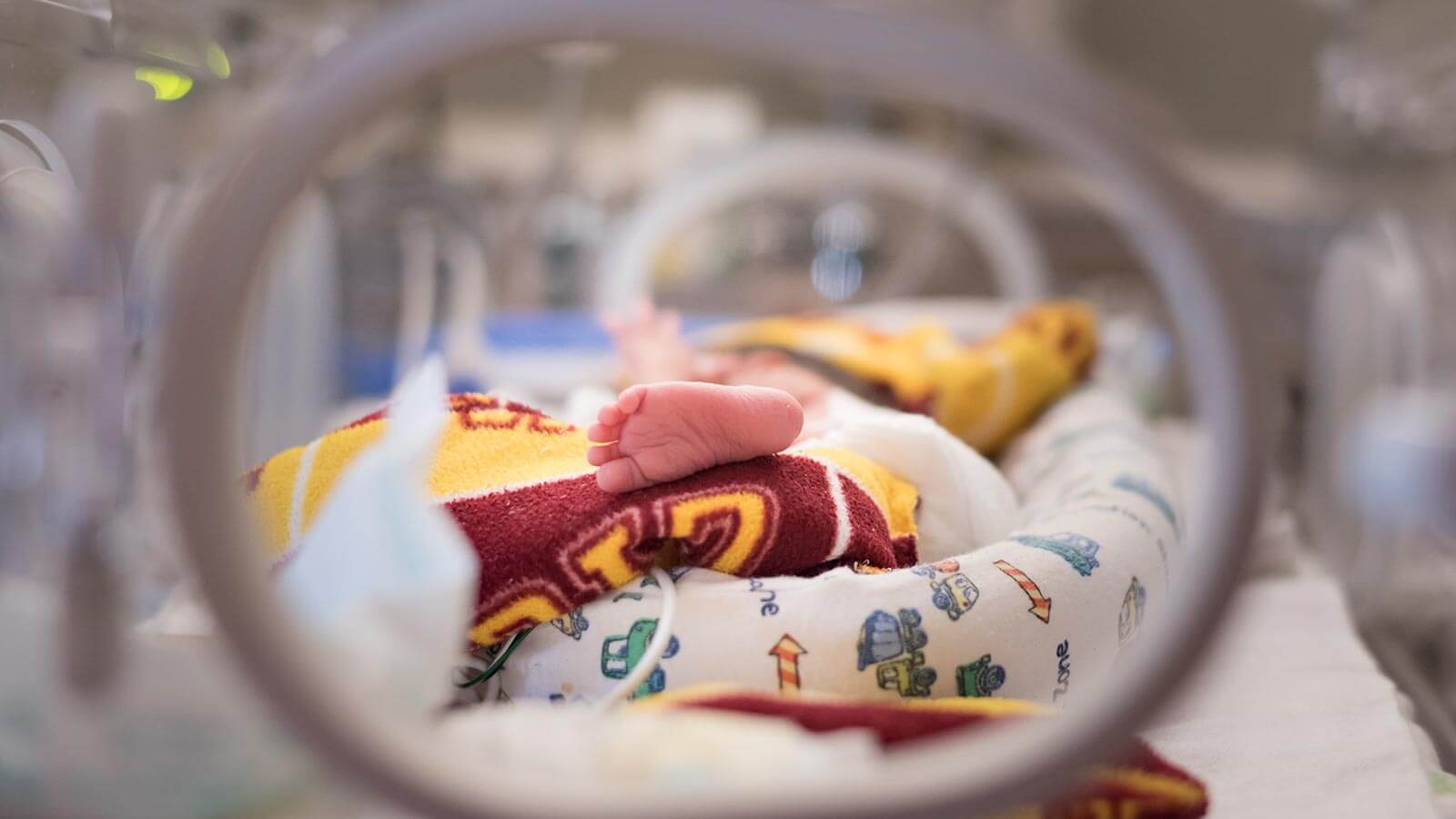 Premature Baby Foot is shown in NICU in his isolette